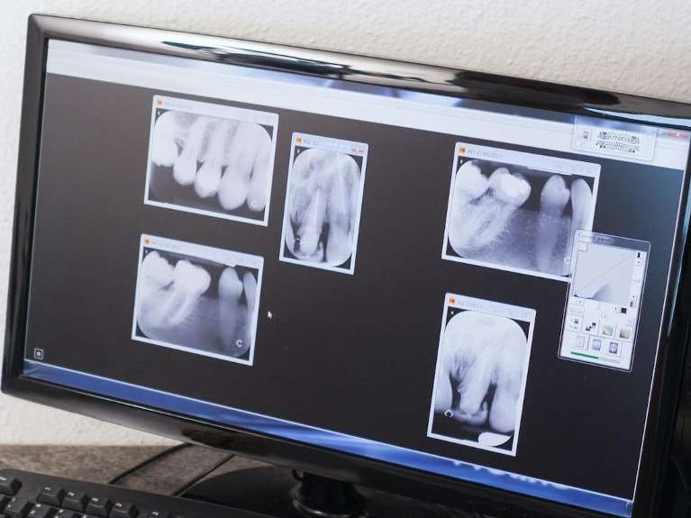 close up of digital x-rays | dental clinic southampton